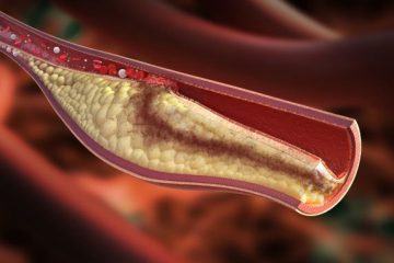 Colesterolo HDL e LDL